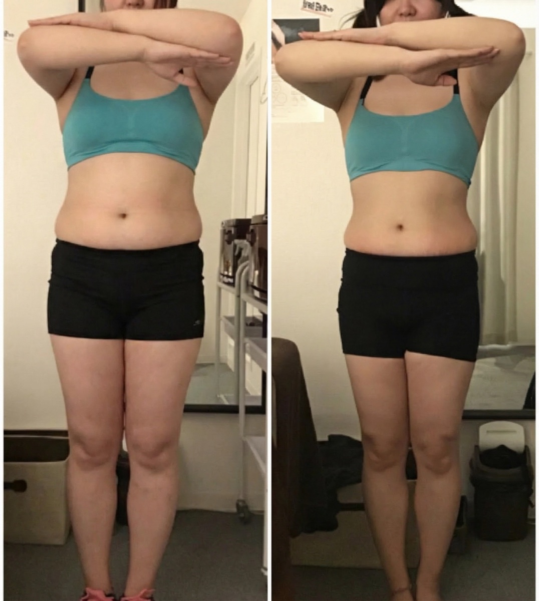 ビフォーアフター例（胸からお腹のシルエット変化）